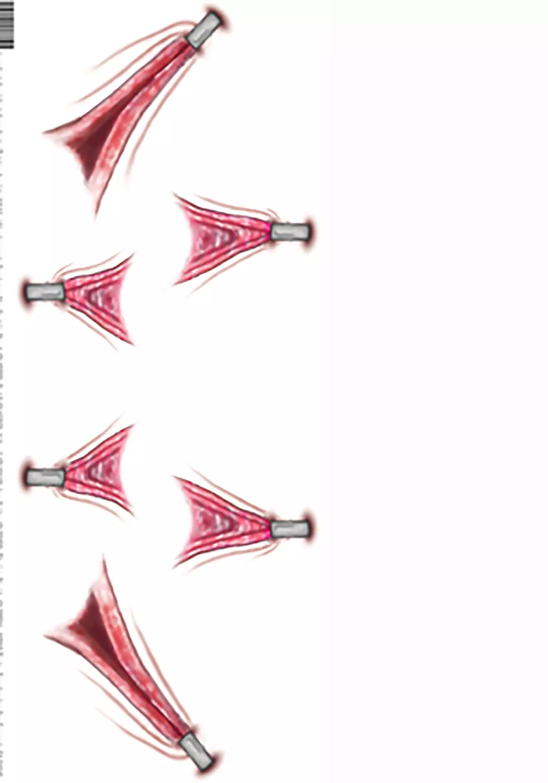 Tinsley Transfers Trauma Stretched Temporary Costume Tattoo 5 Tinsley Transfers Trauma Stretched Temporary Costume Tattoo - Image 3